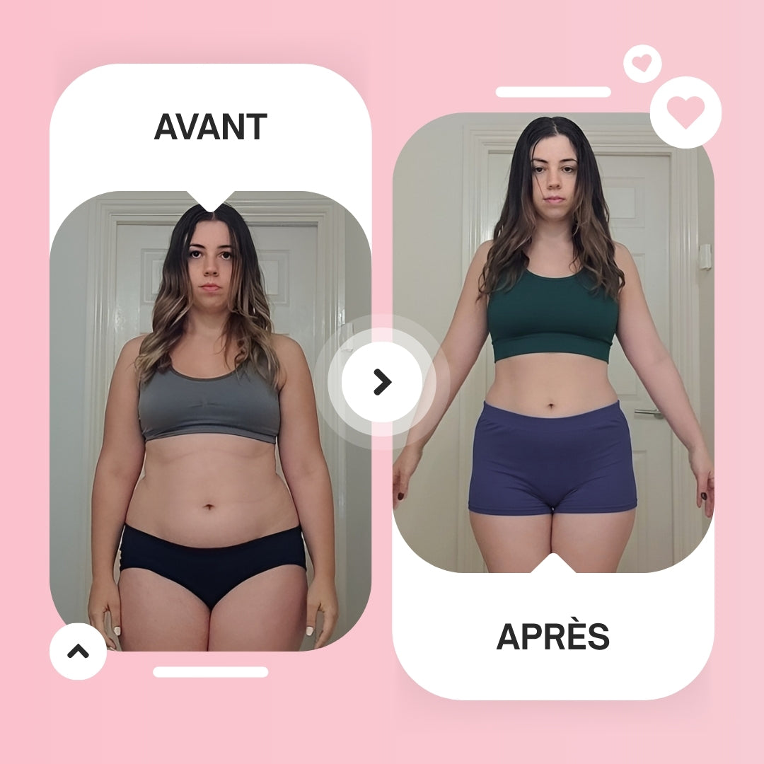 Slimeus (By ADEUS) - Crème vergetures