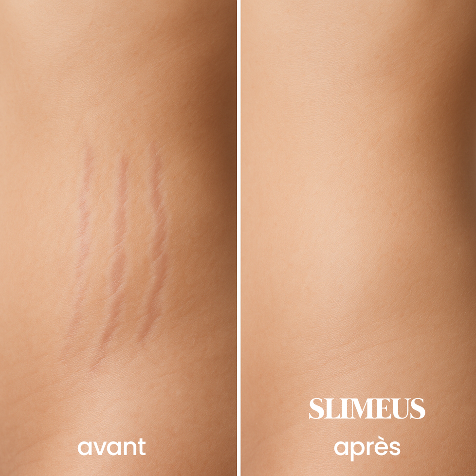 Slimeus - Crème Anti-vergetures